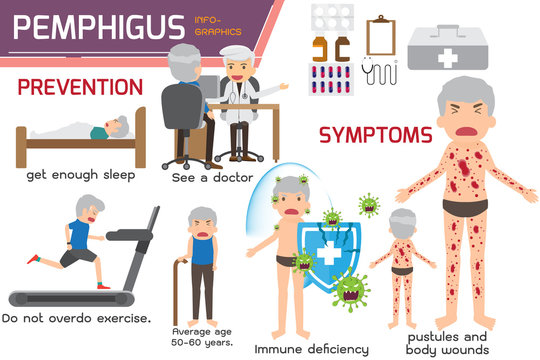 A case of pemphigus foliaceus. Pemphigus foliaceus infographics elements. symptoms and prevention for Pemphigus. health care and medical infographics design. vector illustration.