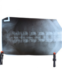 X ray of the lumbar spine, spine on x-ray