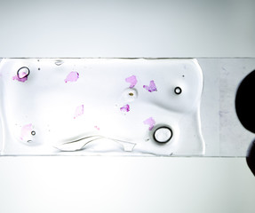 Slices of the tumor under glass. Histological examination of tumor cells for the presence of cancer