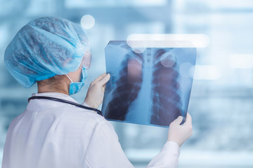 Doctor looking image of the lungs .
