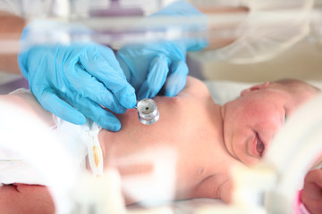 Newborn baby in intensive care. Life saving concept. The child lies in a medical couvez. - obrazy, fototapety, plakaty