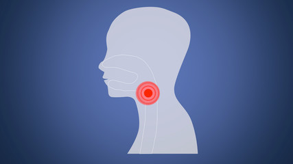 Sore Throat side Profile Silhouette with Ache Location. Adult and children feel Pain in Throat, design illustration.