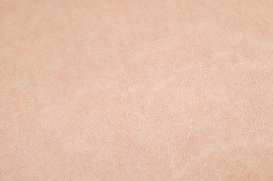 Macro of human skin. Human skin texture background