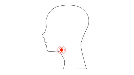 Sore Throat side Profile Silhouettes with Ache Location. Adult and children feel Pain in Throat, design illustration.