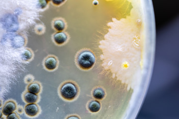 Backgrounds of Colony CharactBackgrounds of Colony Characteristics of Fungus and algae in petri...