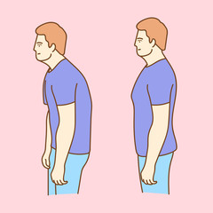 Impaired posture position defect scoliosis and ideal bearing.