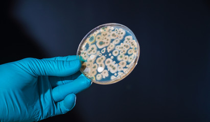 petri dish with microbe colony in doctor hand