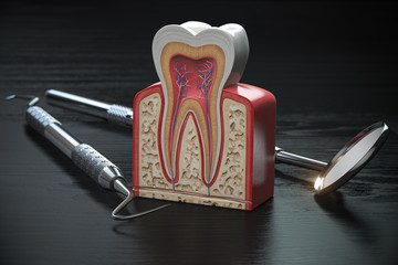 Tooth model cross section with dental tools on black wooden table. Close up. Dental treatmant and hygiene concept.