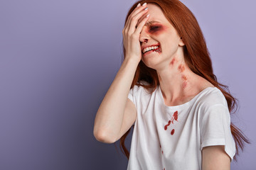 crying girl got a shinner during a fight with her boyfriend. close up portrait, copy space
