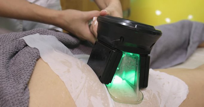 Woman getting cryolipolysis fat treatment in beauty or spa salon