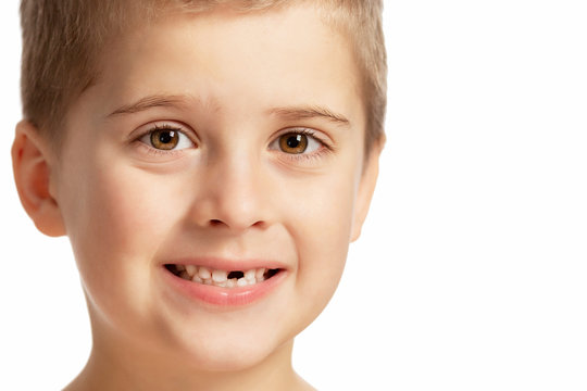 A boy without a front tooth smiles. Close-up. Isolated over white background.
