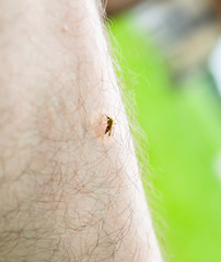 Mosquito sitting on the leg. Insects bite in the summer. Dangerous nature. Itchy body.