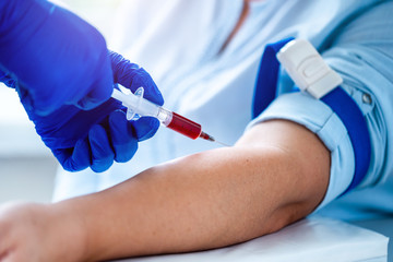 Nurse takes blood from a vein for laboratory test. Medical tests in hospital
