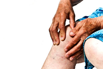 Leg diseases of old people, knee pain