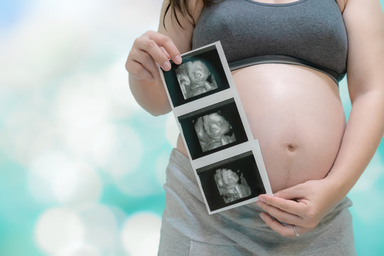 pregnant woman holding an ultrasound picture