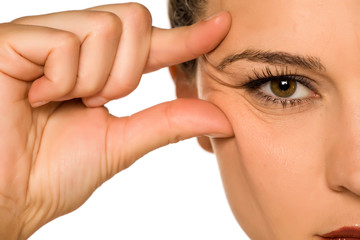young woman pinching her eye wrinkles with her fingers on a white background - obrazy, fototapety, plakaty