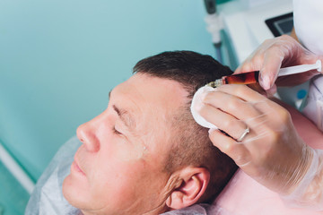 Treatment of baldness with beauty injections. Cosmetologist hands in gloves make a subcutaneous...