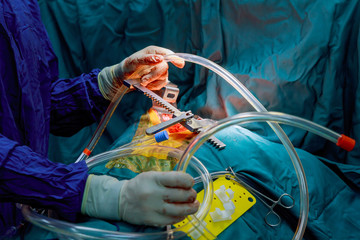 Surgeon with surgical instrument during the open heart operation