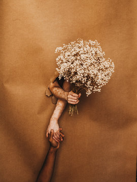 Vitiligo skin girl