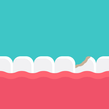 Caring for teeth, broken teeth and cavities with turquoise color background flat design vector illustration