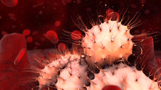 Cancer cell in human body causing tumors - 3D render