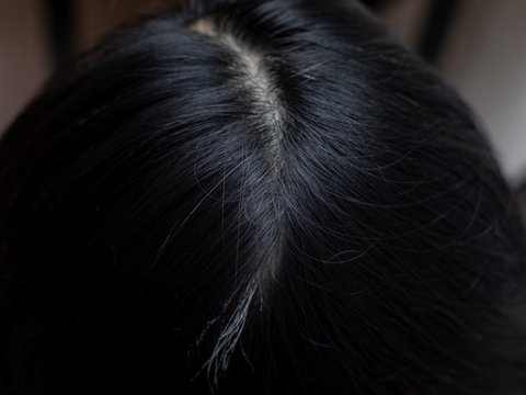 Young woman shows her white hair roots