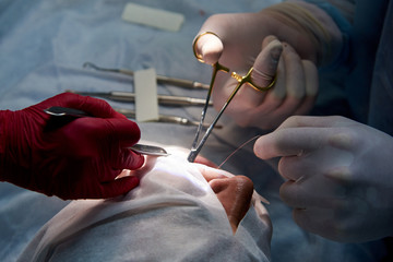 Surgery in the dental clinic.Doctor sews up a wound in the patient's mouth after the operation in...