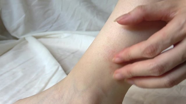Closeup shot of a young woman scratching her ankle, 4K