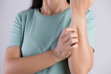 Close up woman arm scratch the itch by hand at home. Healthcare and medical concept.