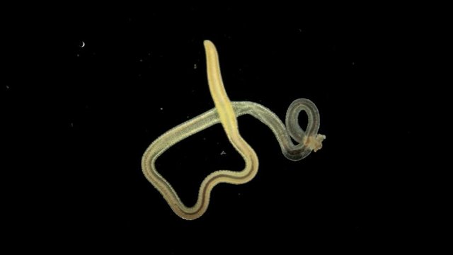 Black Sea plankton and zooplankton under a microscope, marine roundworm, species not identified, possibly nematode