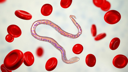 Wuchereria bancrofti, a roundworm nematode, one of the causative agents of lymphatic filariasis, 3D illustration showing presence of sheath around the worm and tail niclei non-extending to tip