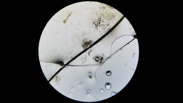 Demodex on dog's skin video taken with microscope under big magnification