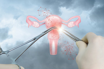 The concept of surgical treatment of the uterus .