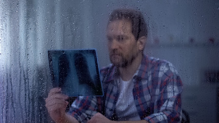 Sad man looking on lungs x-ray, fatal disease, no hope for recovery, rainy day