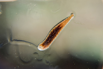 Leech on the glass. Bloodsucking animal. subclass of ringworms from the belt-type class. Hirudotherapy