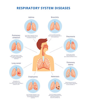Human respiratory system diseases informative diagram vector illustration.