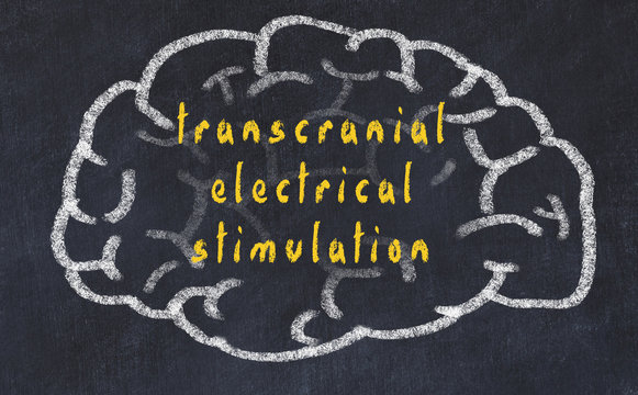 Drawind Of Human Brain On Chalkboard With Inscription Transcranial Electrical Stimulation