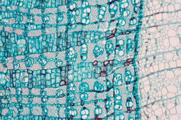 Cross section - Phloem is a type of tissue in vascular plants that transports water and some...