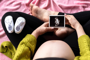 Expectation. Top view of pregnant woman dreaming about being a mother