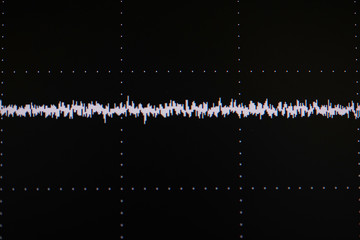Display signal of medical equipment before surgery in operating room