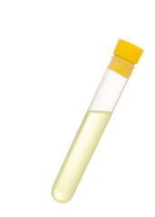 Test tube with yellow liquid, could be urine sample, isolated on white background.