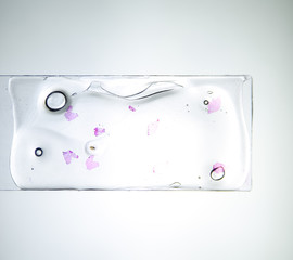 Slices of the tumor under glass. Histological examination of tumor cells for the presence of cancer