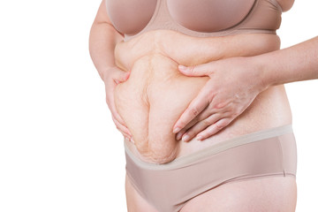 Tummy tuck, flabby skin on a fat belly, plastic surgery concept