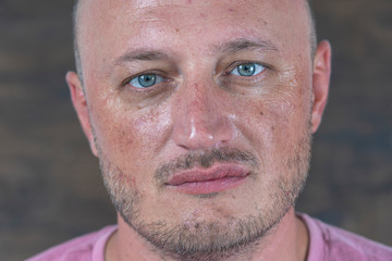 Portrait of middle-aged caucasian bald man looking straight at camera, close up