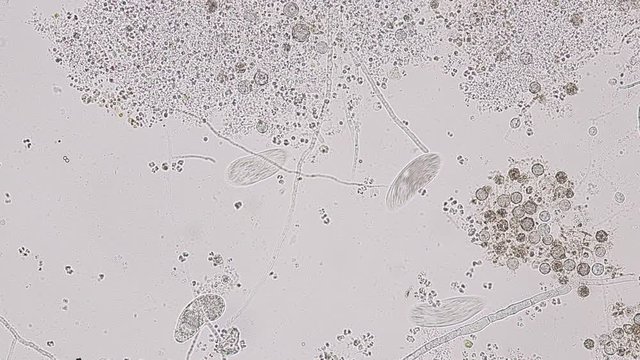 Paramecium caudatum is a genus of unicellular ciliated protozoan and Bacterium under the microscope.