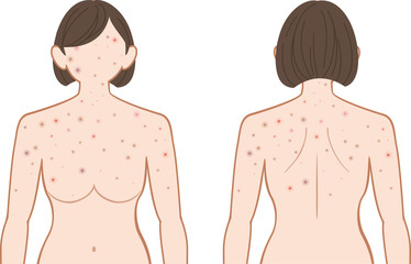 できもの　上半身　女性