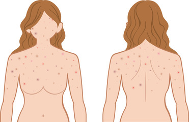 できもの　上半身　女性