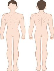 Fototapeta premium できもの 全身 男性