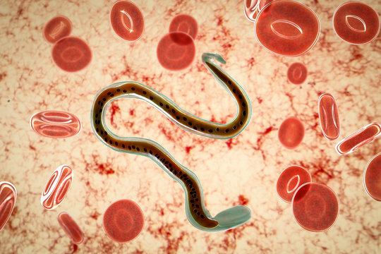 Wuchereria bancrofti, a roundworm nematode, one of the causative agents of lymphatic filariasis, 3D illustration showing presence of sheath around the worm and tail niclei non-extending to tip