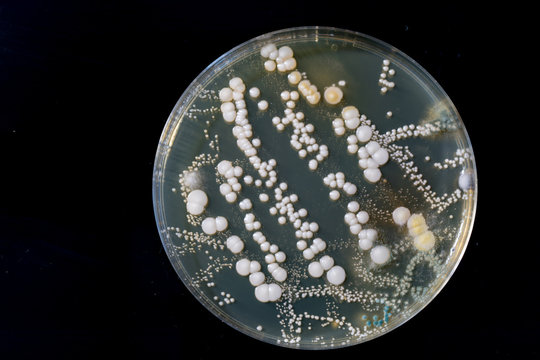 petri dish with bacteria, isolated on black